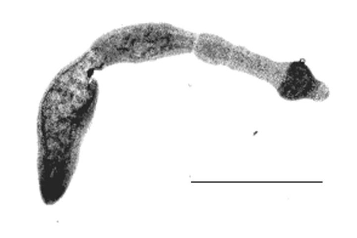 Echinococcus multilocularis