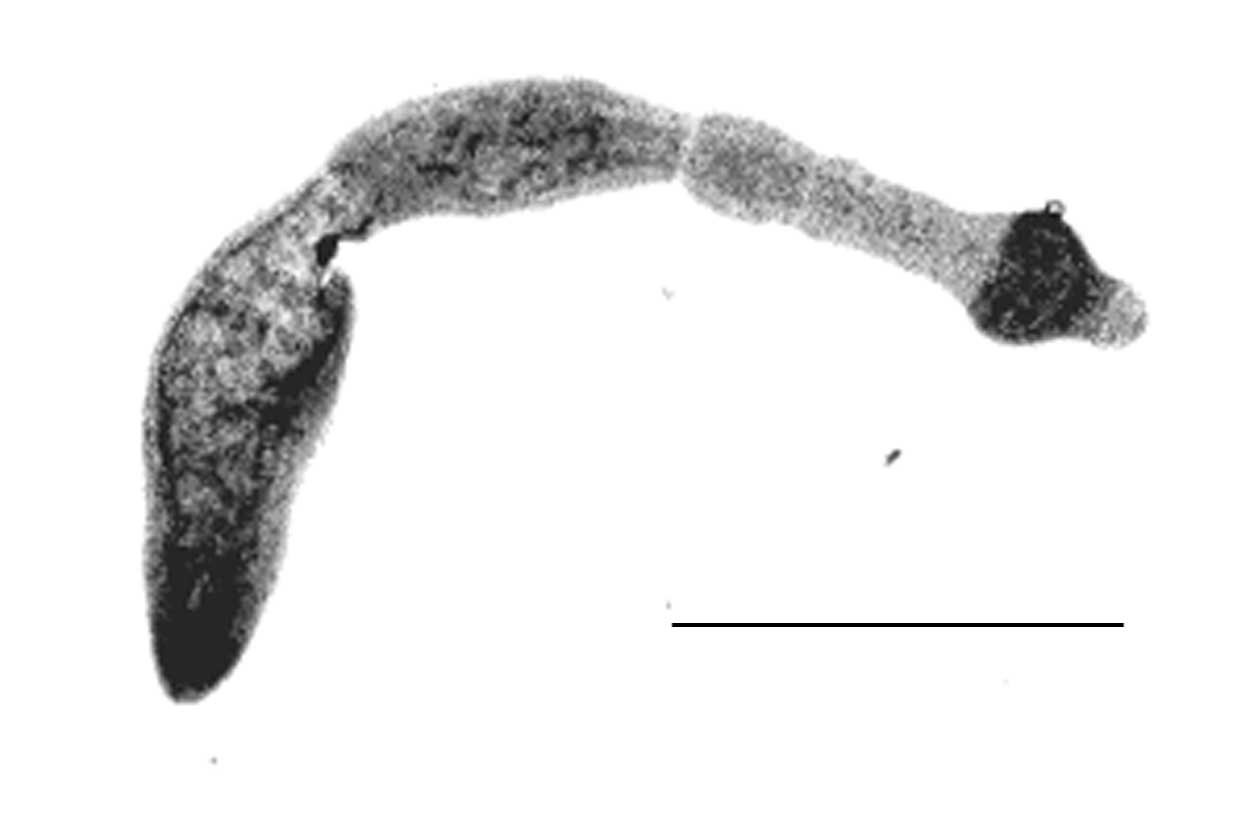Echinococcus multilocularis - Черговий по Мюнхену Echinococcus multilocularis
