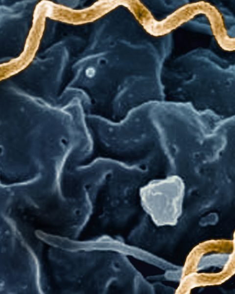 Treponema pallidum Bacteria Syphilis