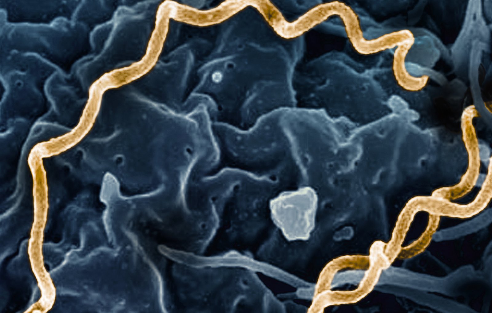 Treponema pallidum Bacteria Syphilis - Черговий по Мюнхену Treponema pallidum Bacteria Syphilis